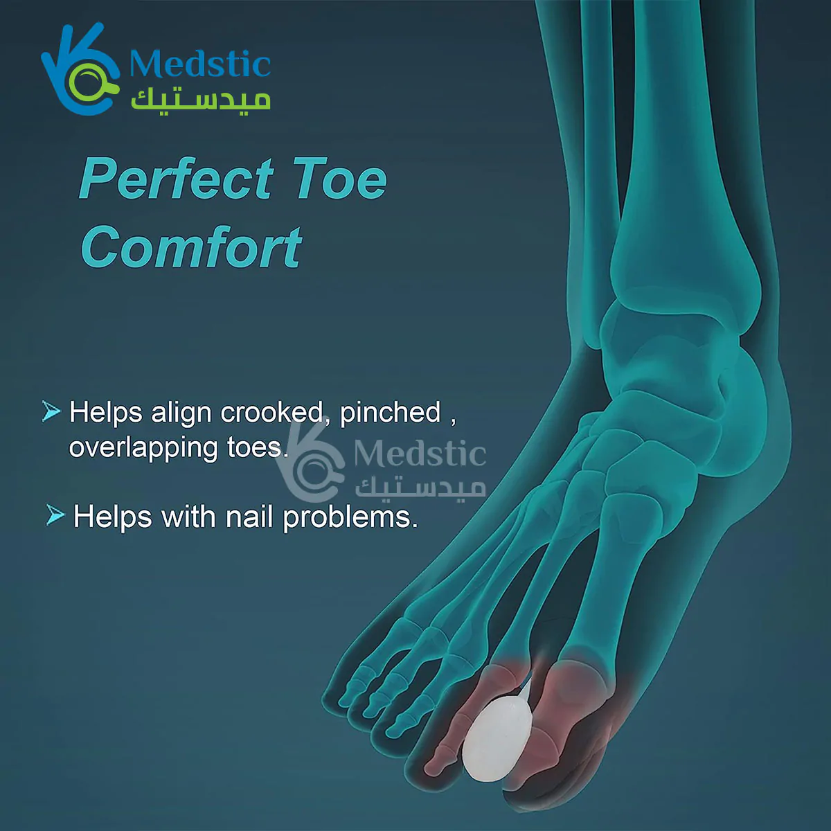 TYNOR Toe Separator Silicone